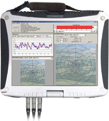 BarnOwl Ver 4 Sinus Soundbook